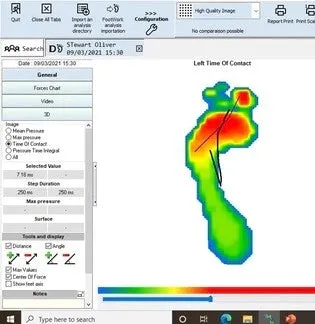 Insole Fitting (Booking Recommended)